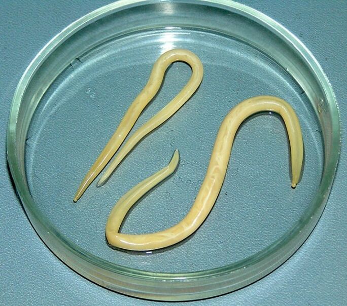 parazit črvov iz človeškega telesa
