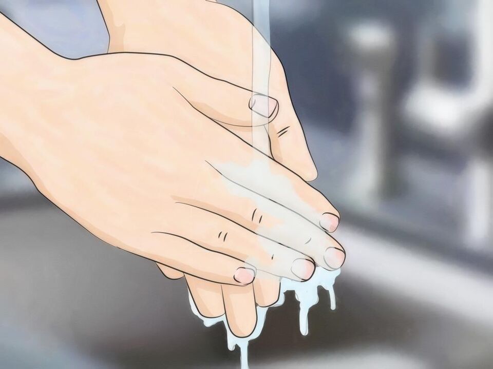 Da bi se izognili okužbi s črvi, izvajajte dobro higieno in si umijte roke. 