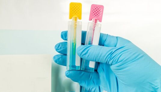 Metode diagnostike parazitov