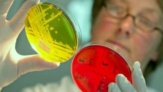 Preiskava testov za odkrivanje parazitov v človeškem telesu